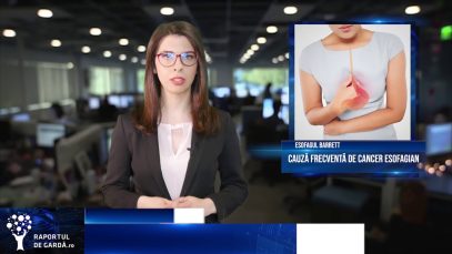 #ASCO18: Aspirina și ezomeprazolul, beneficii în prevenția cancerului esofagian
