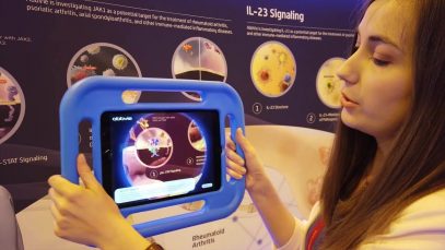 #EULAR2019-VlogRG. Realitatea virtuală: ce se petrece în interiorul celulelor inflamatorii?